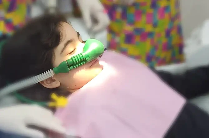 Sedação Consciente com Óxido Nitroso: Guia completo e Questões frequentes