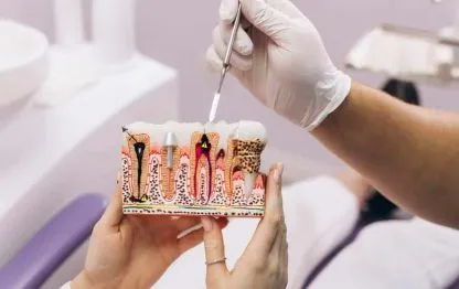 O que é tratamento de canal? Como é realizado pelo Dentista?