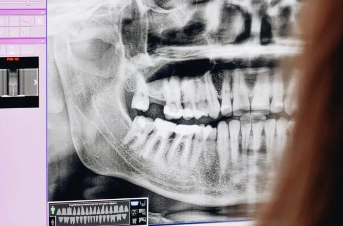 Cirurgia Dentária