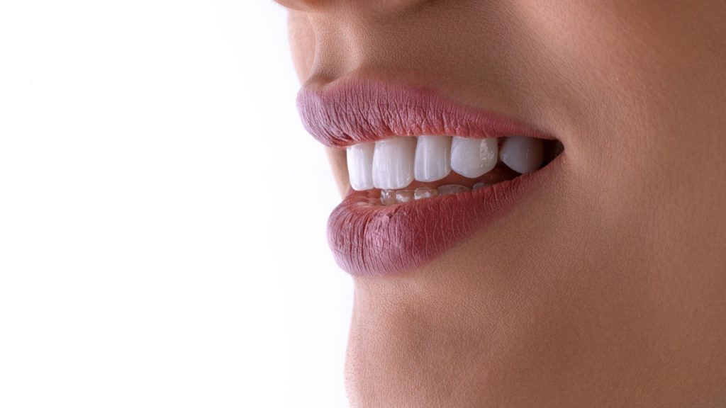 Periodontia 3 Perfil aproximado de dentes com retração gengival severa e raízes expostas, evidenciando a necessidade de enxerto gengival na Clínica Muglia.