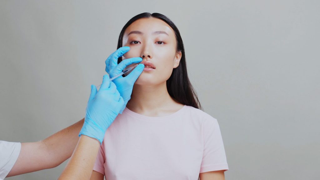 Procedimento de preenchimento labial ilustrando realização por cirurgião-dentista na Clínica Muglia, demonstrando aplicação técnica de ácido hialurônico para escultura e volume dos lábios.