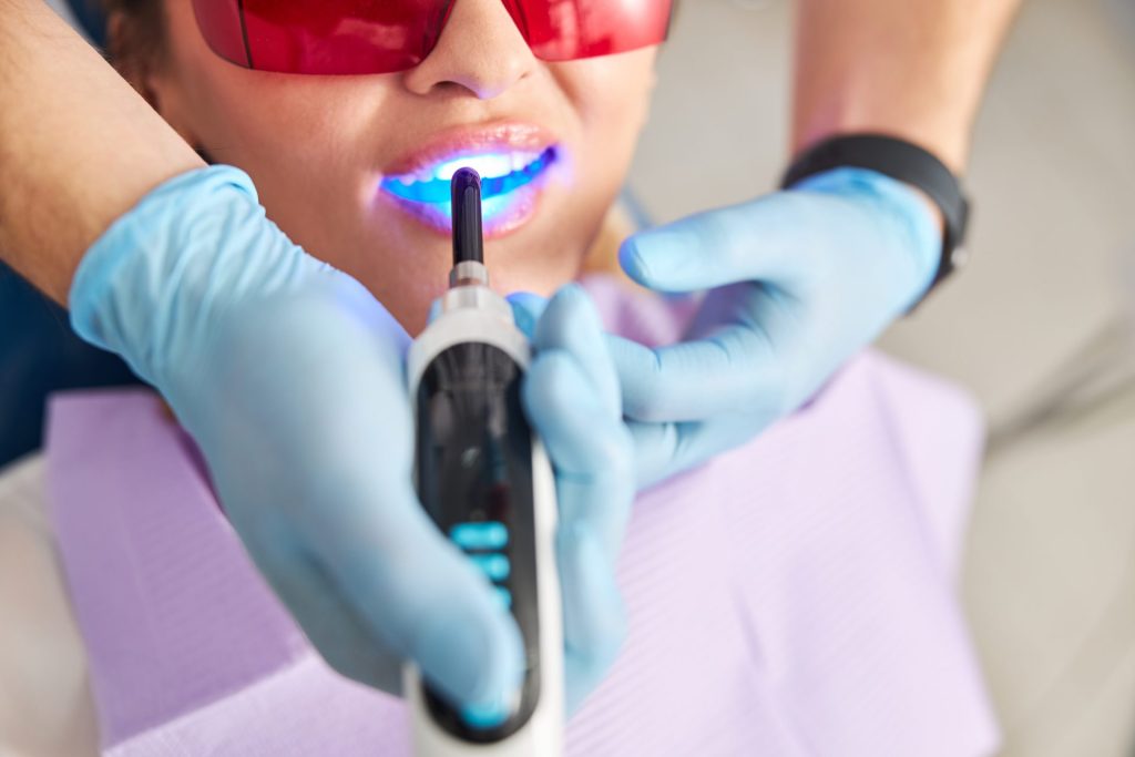 uma pessoa na cadeira do dentista recebendo aplicação de luz para a confecção de restauração estética nos dentes anteriores
