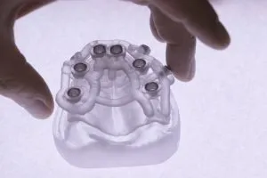 Ilustra como são os guias cirúrgicos para implante guiado