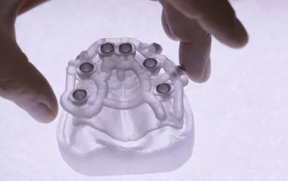 Implante Guiado: Precisão e Tecnologia para o Seu Sorriso na Clínica Muglia
